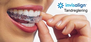 invisalign-1500x700.jpg