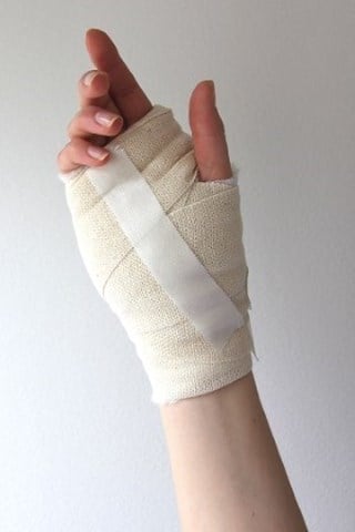 bandage-efter-karpaltunneloperation-300x450.jpg